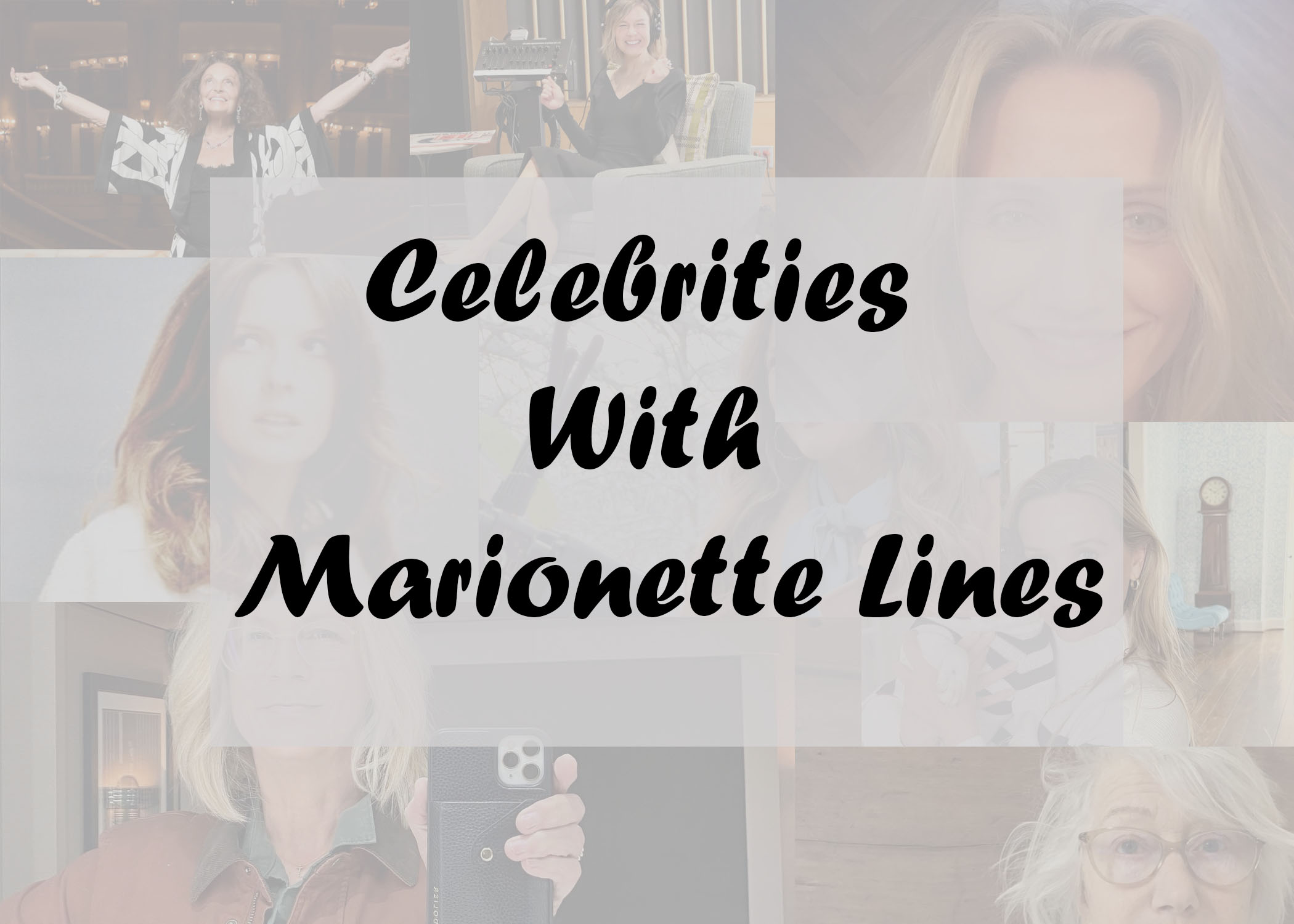 Celebrities with Marionette Lines